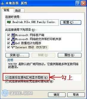 本地连接不见了？快速找回消失的网络图标，解决无法上网的烦恼